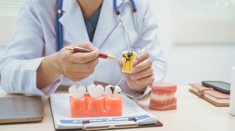 Dentist at 92 Dentistry in Portland, OR explaining chipped or cracked tooth with a dental model.