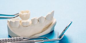 Dental crown model with tools at 92 Dentistry, Portland, OR.