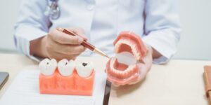 Dentist at 92 Dentistry in Portland, OR explaining cavity prevention and treatment using tooth and jaw models.
