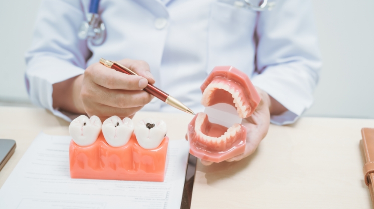 Dentist at 92 Dentistry in Portland, OR explaining cavity prevention and treatment using tooth and jaw models.