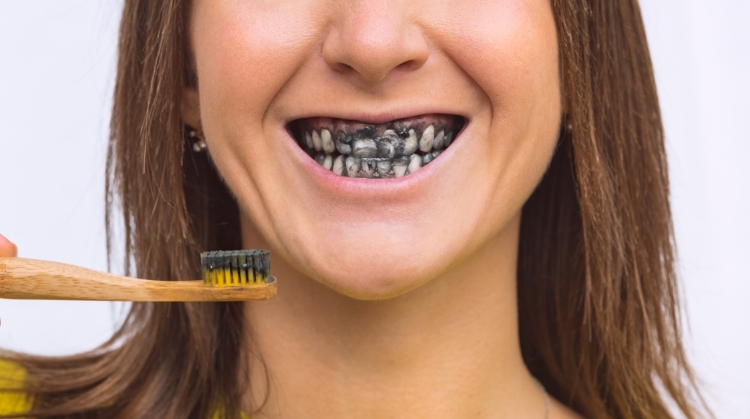 Woman brushing teeth with charcoal toothpaste, showing black-stained smile – 92 Dentistry, Portland, OR.