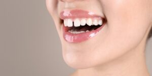 Close-up of a smiling woman showing gaps between her front teeth – 92 Dentistry, Portland, OR