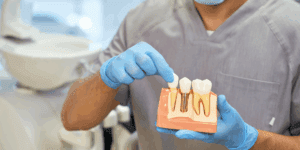 Dentist showing a model of a dental implant and teeth.